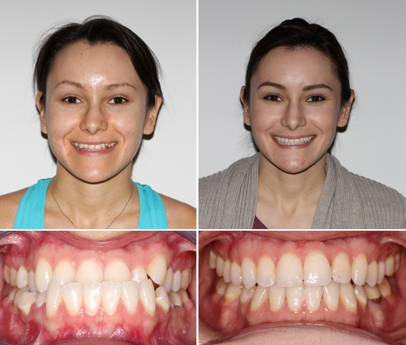 Patient Before & After image