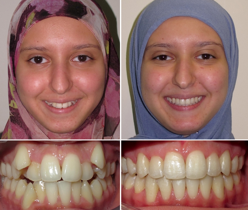 before & After Treatment image