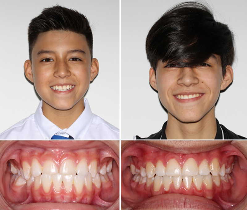 Child photo with before & after treatment