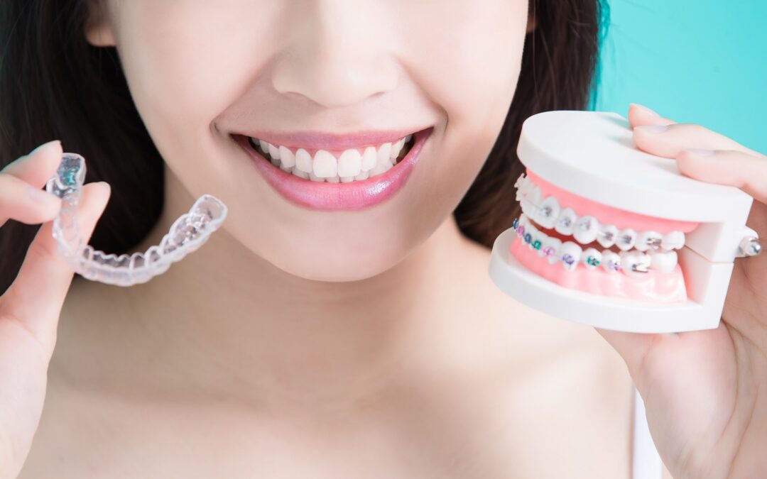 metal braces vs invisalign which is best