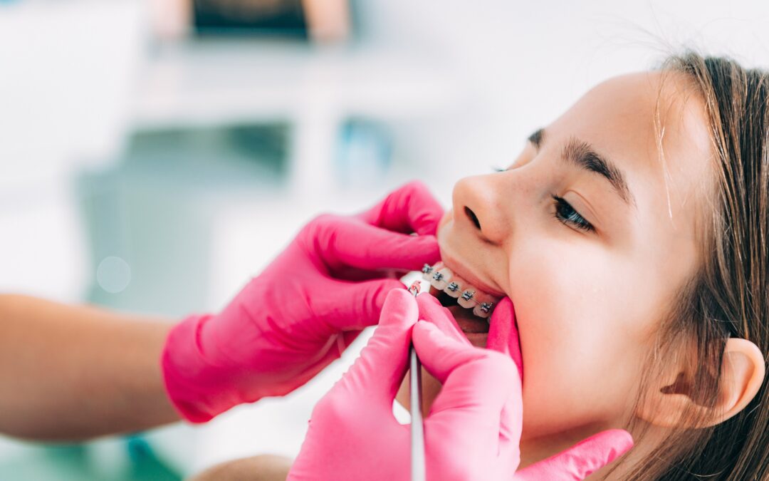 what happens If braces and do not brush your teeth