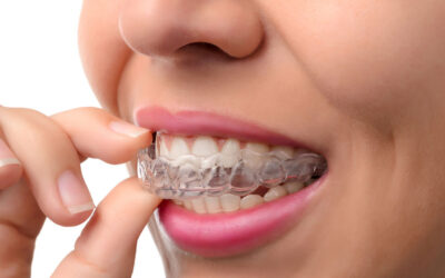 Invisalign: The Best Option for Adults?
