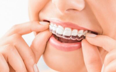 How to Get the Most Out of Your Invisalign Treatment
