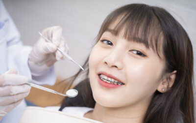What are the Different Types of Orthodontic Appliances?