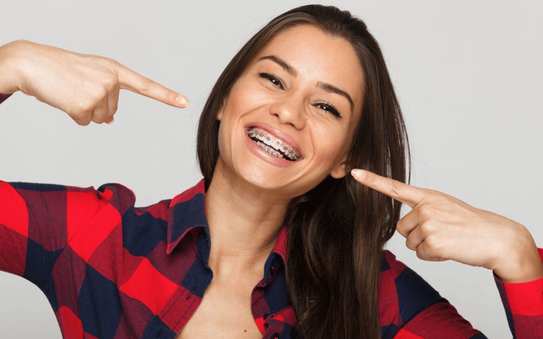 types of braces in innisfil